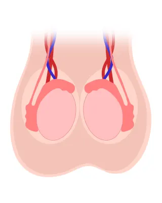 img-escrotoplastia-en-bogota-1-LCP