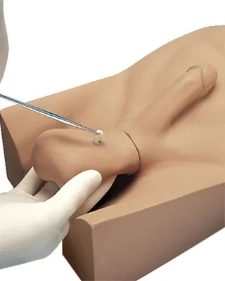 img-vasectomia-en-bogota-1-LCP